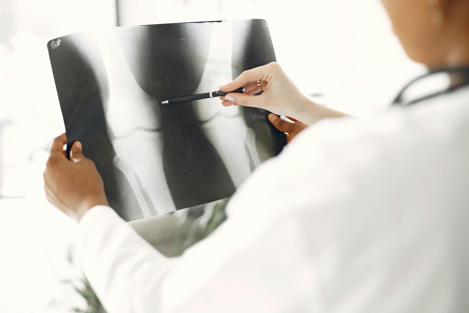 Un professionnel de la santé examine attentivement une radiographie de la jambe, en soulignant les détails avec un stylo.